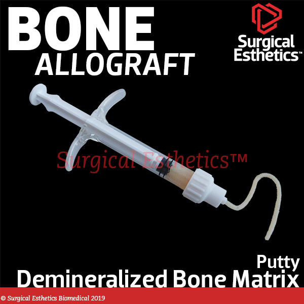 Ossif-i Demineralized Putty Allograft (DBM) | Surgical Esthetics | Surgical Esthetics Bone Graft