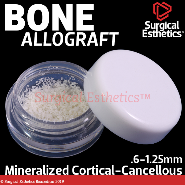 Ossif-i Mineralized Cortico-Cancellous graft | Surgical Esthetics | Surgical Esthetics Bone Graft