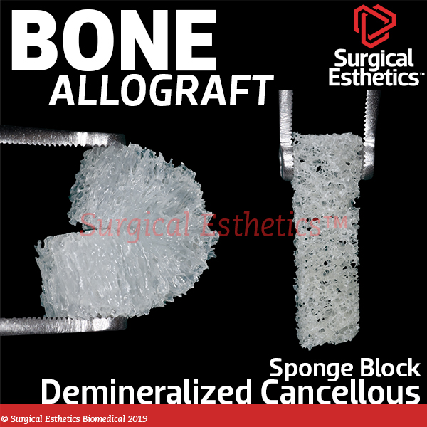 Spongy sponge bone graft