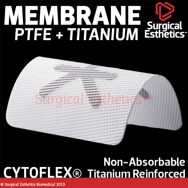 Ostéotique – membrane en PTFE haute densité Non adsorbée, renforcée en  titane, cyplast, postérieur