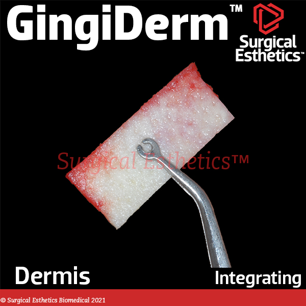 GingiDerm Acellular Dermis | Surgical Esthetics Bone Graft